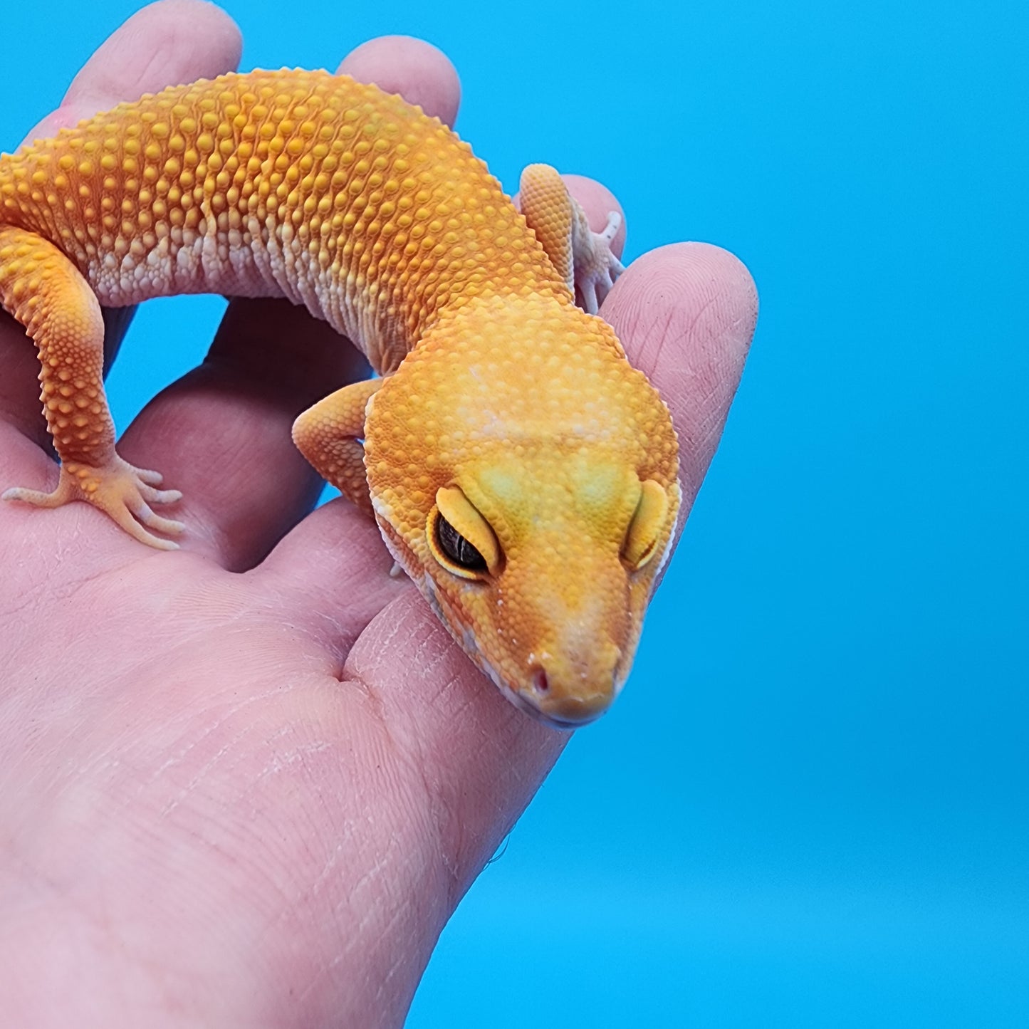 Female Super Giant Super Hypo Blood