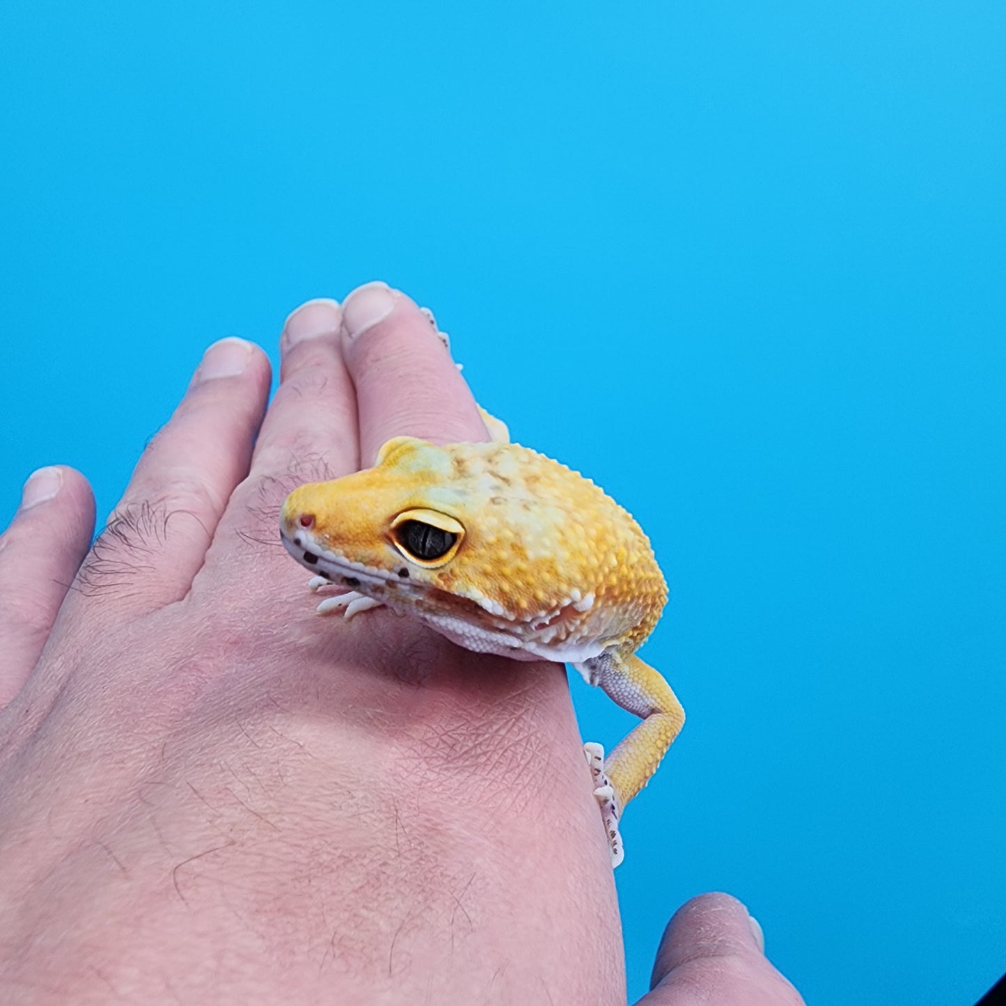 Male Giant Blood Hypo