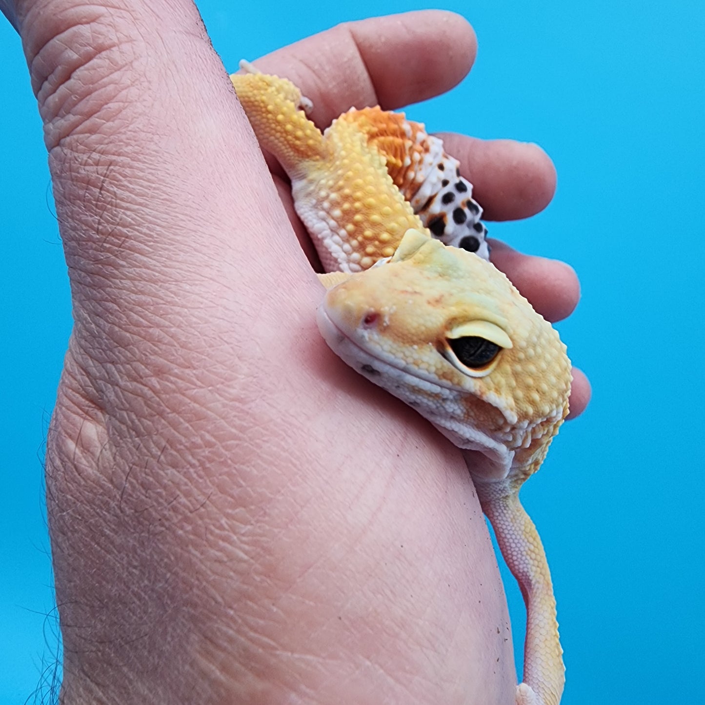 Female Giant Blood Super Hypo